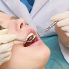 Dental Check-Up
