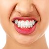 Woman with Bruxism
