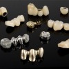 Dental crowns and bridges