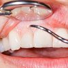 Periodontal Examination