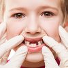 Children's Periodontal Health