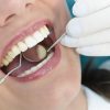 Periodontal Maintenance Checkup